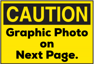 Caution, graphic photo image next page
